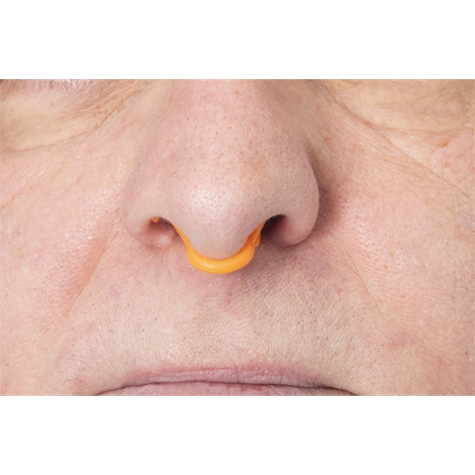 Lot de 2 stop ronflements